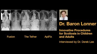 Dr. Baron Lonner, Innovative Procedures for Scoliosis in Children and Adults, with Dr. Derek Lee