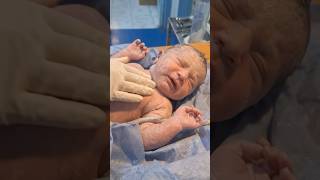 Tiny newborn baby starts crying 🥺👶 #shorts Tiny newborn baby starts crying 🥺👶 #shorts