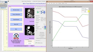 Brain Tumor Detection Classification using NEURAL NETWORK
