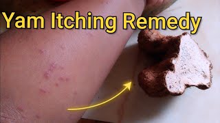 How To Get Rid Of Yam Itching Immediately