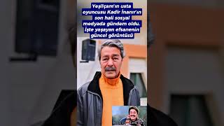 Kadir İnanır&#39;ın Son Hali Görenleri Şaşırttı!
