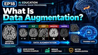 What Is Data Augmentation | Brain MRI & Alzheimer's AI Explained | AI Education EP18