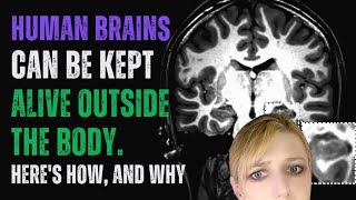 Human Brains Can Be Kept Alive Outside the Body. Here's How, and Why