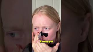 Çocuk Yanlışlıkla Tüm Vücuduna Ağda Yaptı