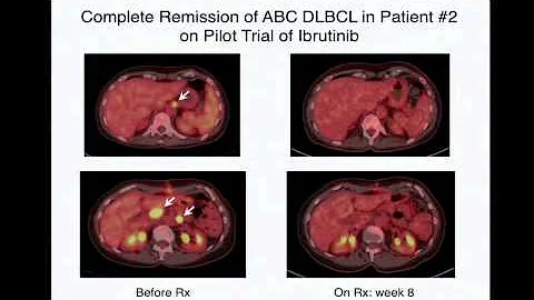 TCGA: Status Report and Insights From Leadership - Louis Staudt