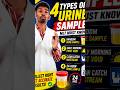 Are You Collecting Urine Samples Correctly? 😳One Mistake in Urine Collection Can Change Results."