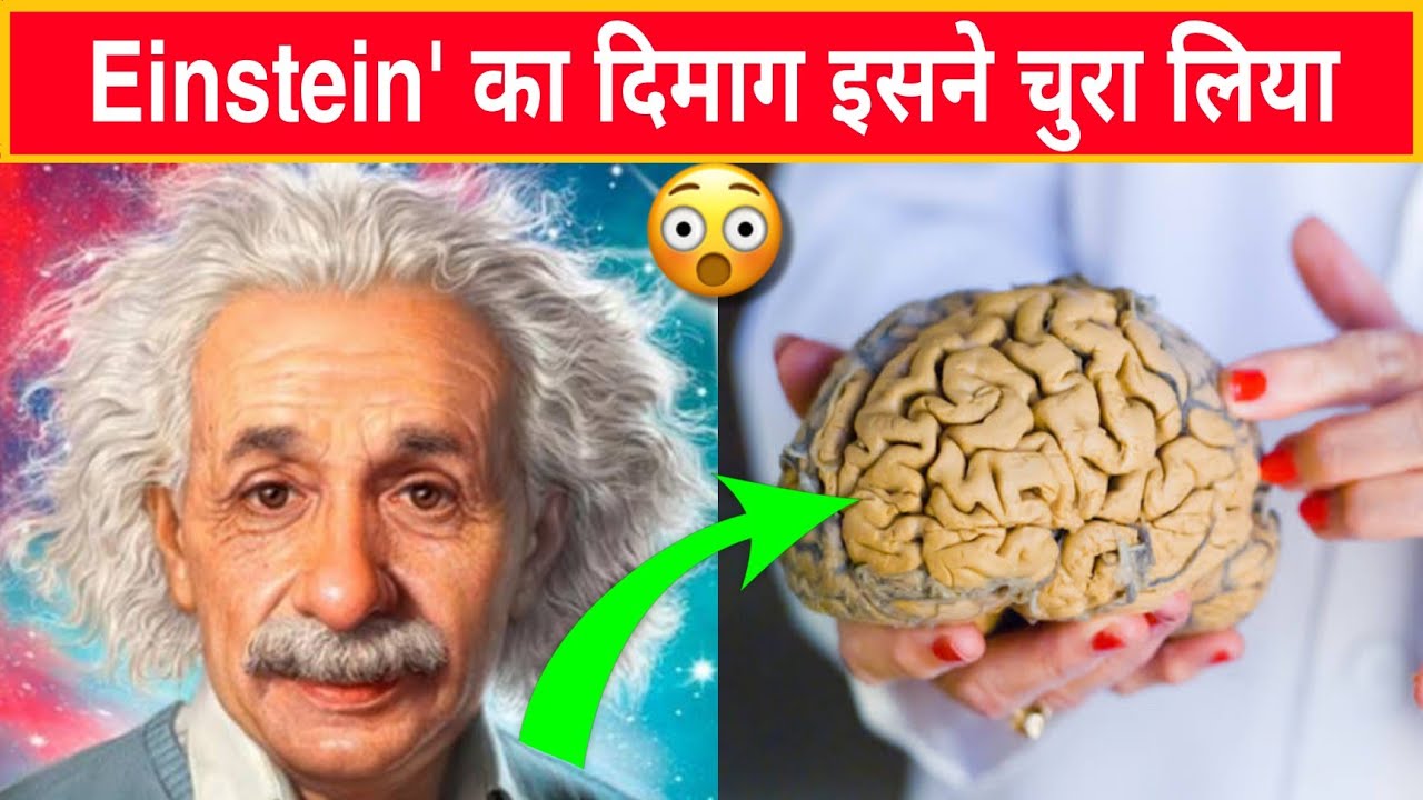 Albert Einstein का दिमाग इसने चोरी की 🤯। Amazing Facts #shorts #facttechz