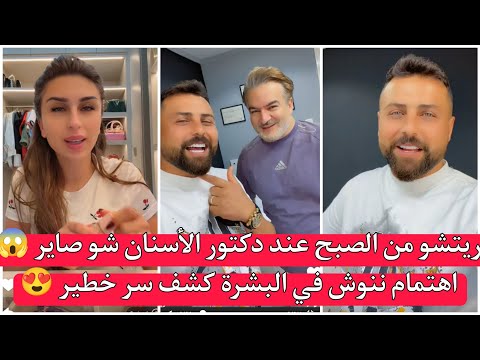 ريتشو وننوش شوفو ريتشو من الصبح عند دكتور الأسنان شو صاير اهتمام ننوش في البشرة كشف سر خطير