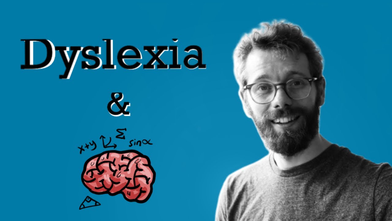 Creative Dyslexics Brains