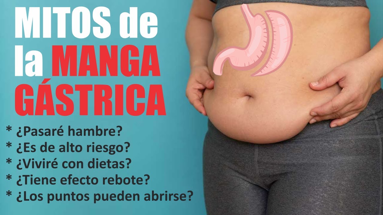 MITOS de la MANGA GÁSTRICA 🔴 Cómo Perder Peso Rápidamente 🔴 Cirugía Bariátrica Perú 🤩 Dr. JUAN MORA