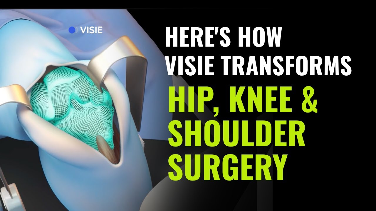 VISIE Transforms Hip, Knee & Shoulder Surgery | Here's How