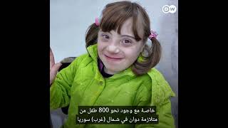 رعاية مجانية للأطفال المصابين بمتلازمة داون في سوريا