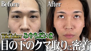 目の下のクマ取り】めちゃくちゃキレイな涙袋ができました！【みやちだ