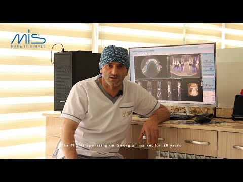 ექ. ამირან აბულაძე და კბილის იმპლანტაცია. MIS Implants