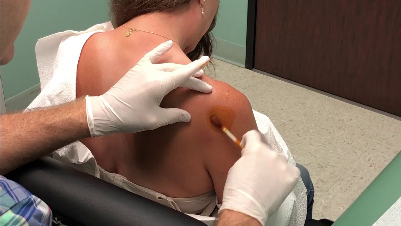 Sunny's Shoulder Has BIG PROBLEMS! Dr. John Gilmore