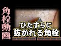 【 角栓抜き動画 】ただひたすらに角栓を抜き続ける動画～A video of simply removing blackheads