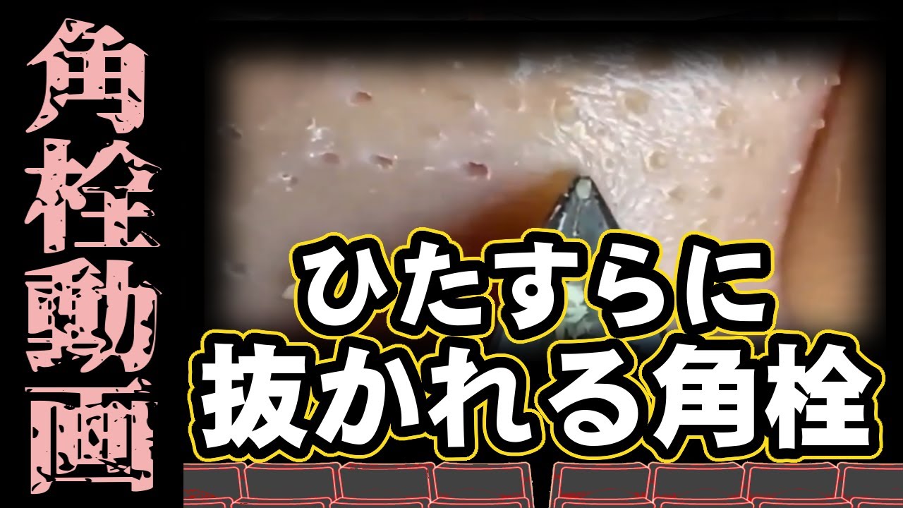【 角栓抜き動画 】ただひたすらに角栓を抜き続ける動画～A video of simply removing blackheads