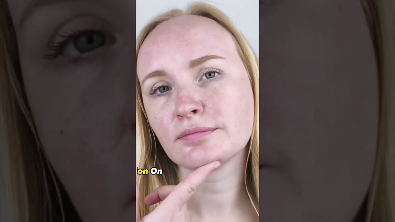 Oily Skin X Lifechart || 