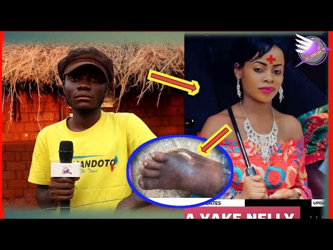 CHANZO CHA KIFO CHA VICTORINA OHANA KAKA AFUNGUKA UKWELI MGUU KUOZA BADO MZIMA TUNAOMBA MISAADA 