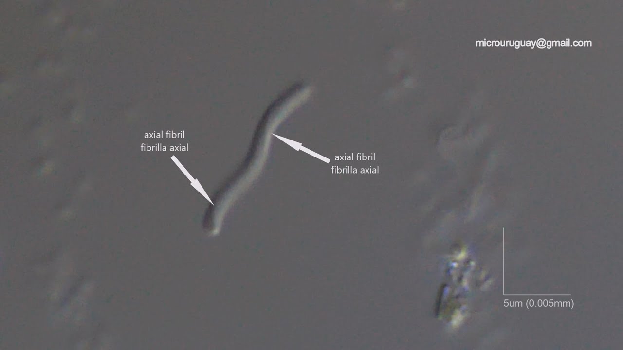 estructura-espiroquetas-spirochetes-structure-youtube