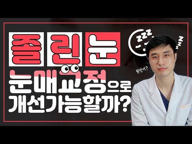 유연한 의사들 [쌍수 편] Ep4 쌍꺼풀 수술과 눈매교정수술의 차이점 우리성형외과☻