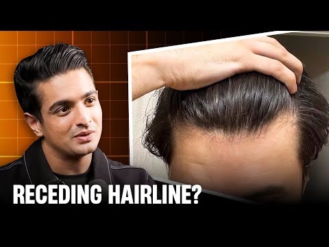 STOP THIS Before Your Hairline Disappears