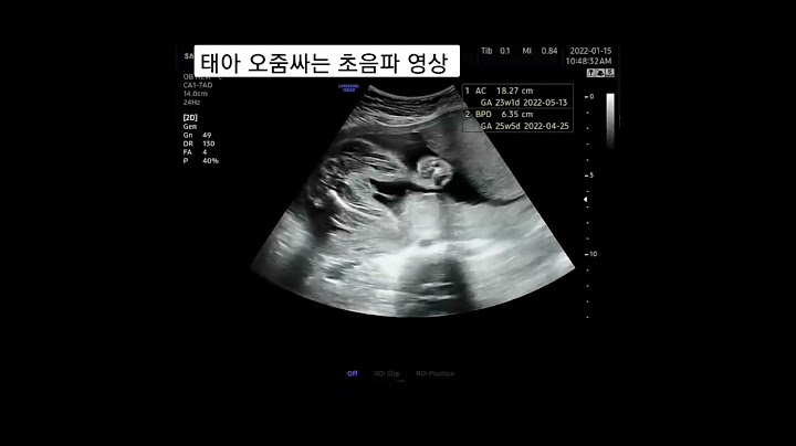 아들내미 엄마뱃속에서 쉬~ 의사님도 보기힘들다고 했어요 #초음파 #예비맘 #흑호띠 #오줌싸는영상 #초음파동영상 #아기 #태아