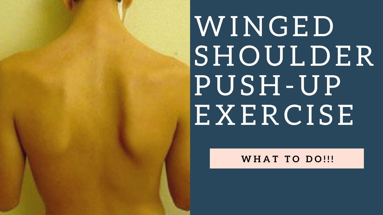 How To Fix A Winged Scapula With The Push Up Plus Serratus Anterior Muscle Exercise!