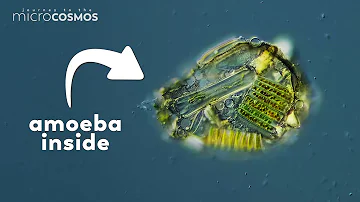 Some Amoeba Make Armor From Their Dead Enemies