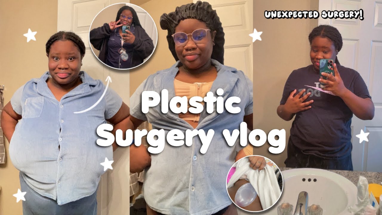 Breast Reduction Surgery Vlog | I waited my whole life for this!