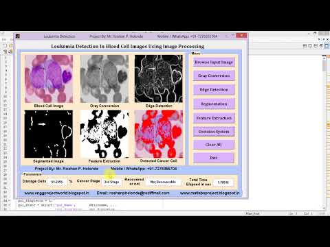 Leukemia Detection from Blood Samples using Image Processing