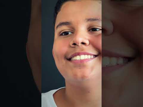 Apresentação de imagen