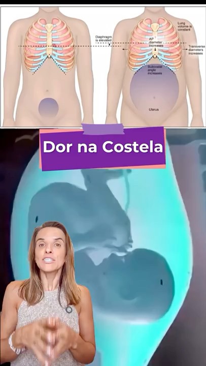 Dor na costela na gravidez não é só chute do bebê - YouTube