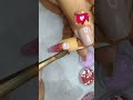 Uña ENCAPSULADA en Acrilico rosa