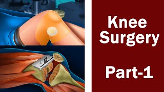 Multi Surgery Hospital | Knee Surgery | Knee Surgical Simulator | #1 screenshot 5
