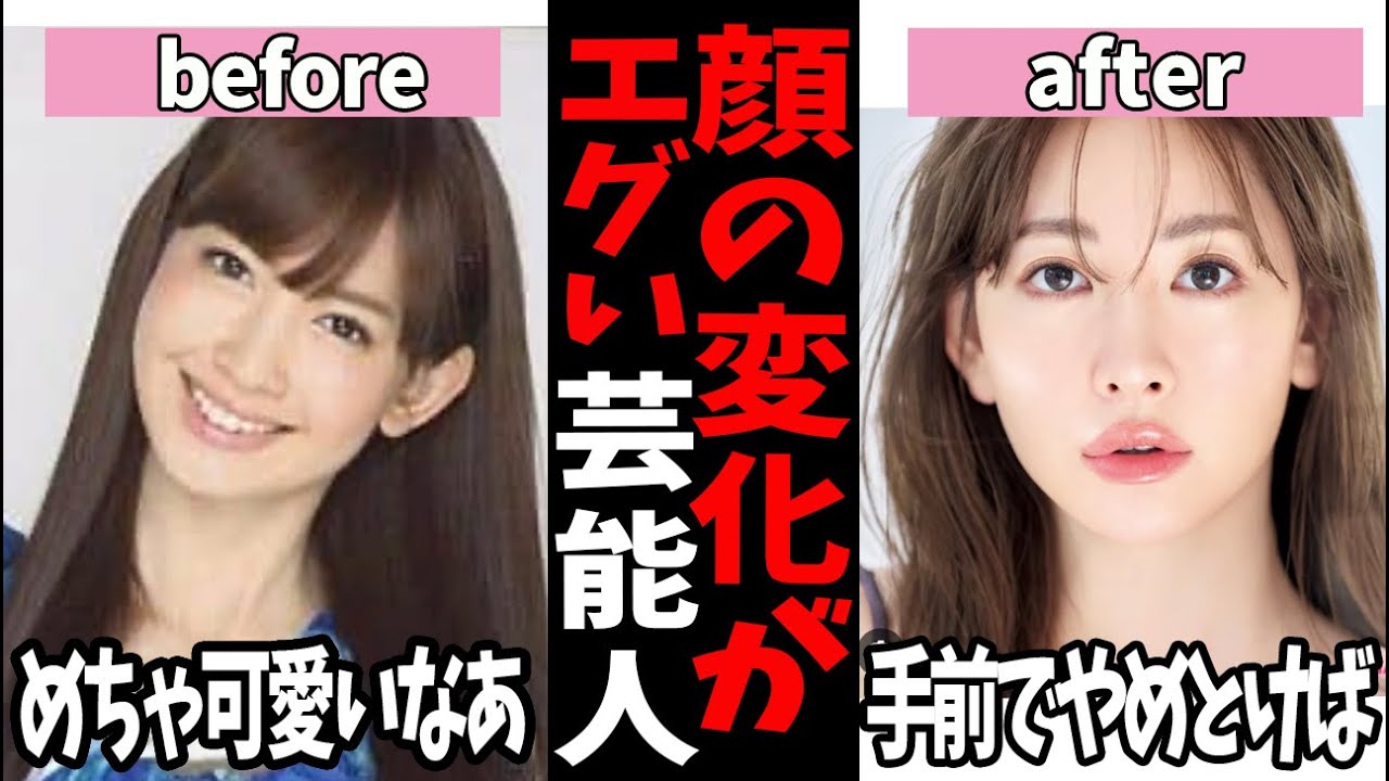 これはさすがにエグい…昔と今で顔の印象が変わりすぎた芸能人たち【ガルちゃん芸能】