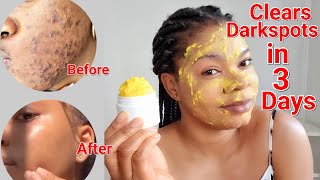 How To Clear Acnes And Darkspots In 3 Days Using This Orange Mask Works 100%