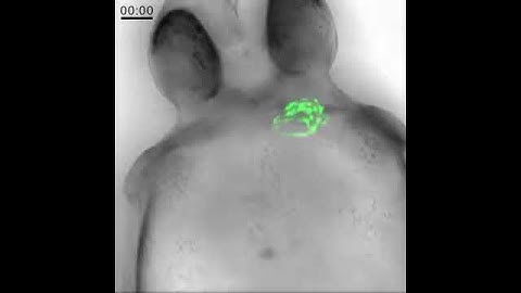 Long-term imaging of zebrafish w light sheet microscopy 3
