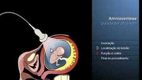 Quanto custa um exame de DNA com o bebê na barriga?