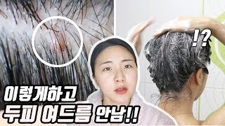 (Very effective...)Shampooing method for greasy+dead skin cell+acne scalp