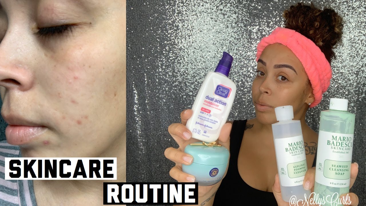 Skincare Routine| How I got rid of acne & acne scars/dark spots |NOT ...