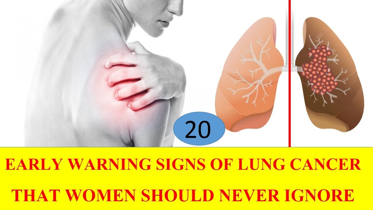 Lung Cancer Early Warning Signs And Symptoms Of Lung Cancer Cancer My Xxx Hot Girl 