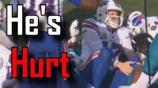 Josh Allen Appears To Be Playing Through Multiple Injuries Jacksonville Jaguars Vs Buffalo Bills
