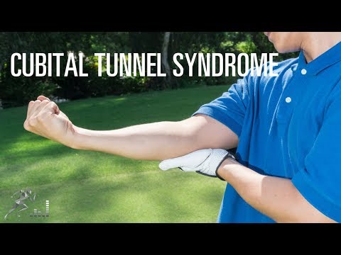 Cubital tunnel syndrome: Signs, symptoms and treatment of this ulnar nerve injury