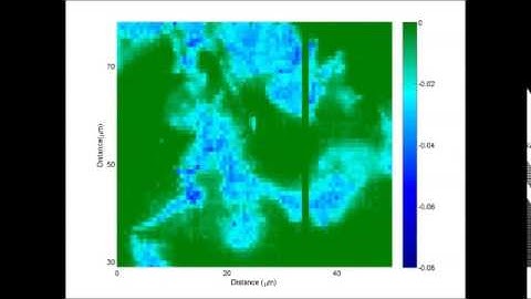 Nanochip maakt filmpje van kankercel