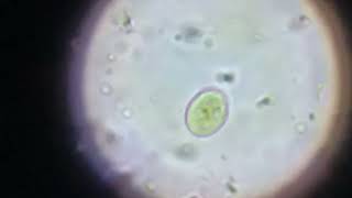 Cyst  Giardia lamblia