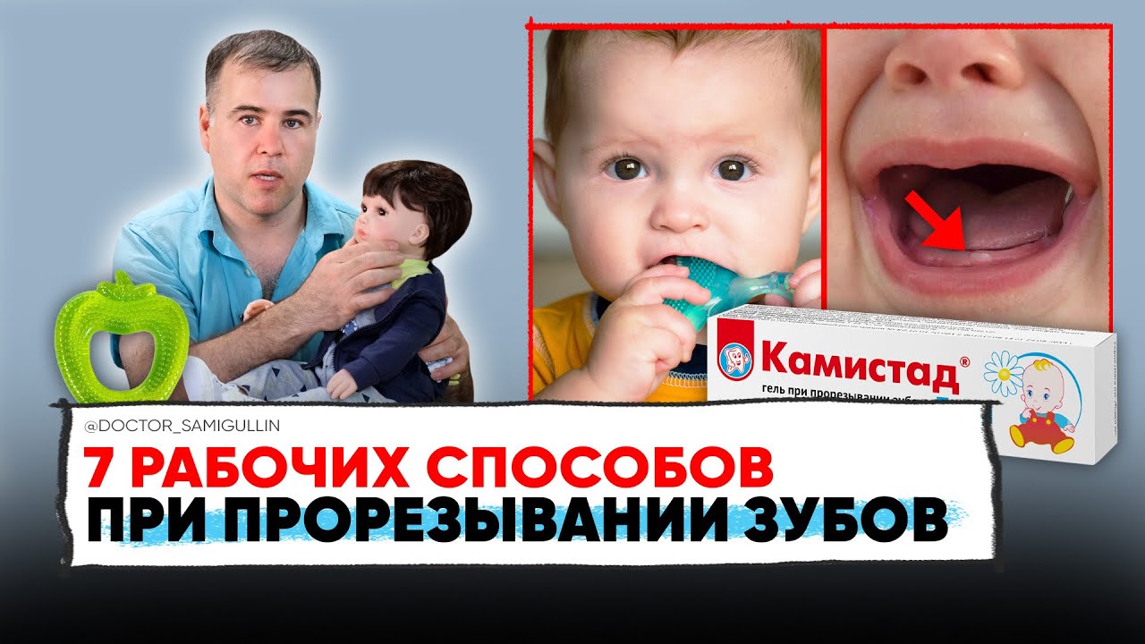 Как ПОМОЧЬ ребенку при ПРОРЕЗЫВАНИИ зубов | Симптомы прорезывания ЗУБОВ у ребенка.