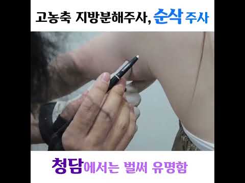 팔뚝순삭주사 시술 및 효과는? — 리연케이의원 원장 영상