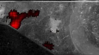 Visualization and measurements of shock waves in cavitating flow