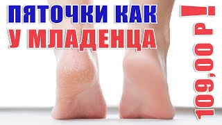 Скажи трещинам на пятках гудбай! Крутой крем для ног по очень бюджетной цене. - Видео от Алла Бьюти